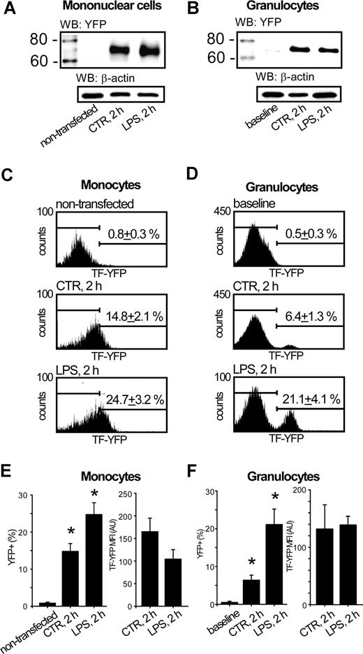 Figure 5. Granulocytes acquire TF expressed in monocytes. Immunoblotting of MNC lysates against YFP demonstrates that TF-YFP fusion protein is well expressed in nucleofected monocytes regardless of LPS stimulation (A). Representative immunoblot shows that TF-YFP fusion protein is acquired by granulocytes, isolated from whole blood reconstituted with TF-YFP–expressing monocytes. WB indicates Western Blot (B). The population of TF-YFP–positive monocytes was increased under LPS stimulation of whole blood, reconstituted with TF-YFP–expressing monocytes (C). The population of CD15 + granulocytes, acquired TF-YFP in whole blood reconstituted with TF-YFP–expressing monocytes, is increased by LPS stimulation (D). Plots summarize the mean percentage and MFIs of TF-YFP + cells from the total CD14 + MNC population (E) or TF-YFP + cells from the total CD15 + granulocyte population (F). Error bars represent SEM. *P < .05 compared with nontransfected monocytes or baseline conditions of granulocytes, respectively.