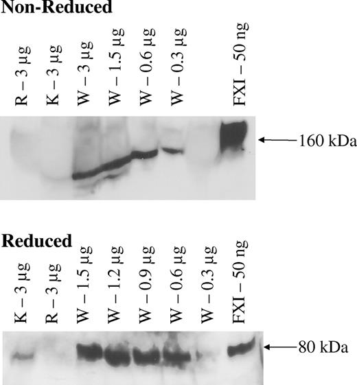 Figure 1. Western blotting of FXI in purified FXI and 3 Rh immune globulin preparations. Note the presence of FXI 160-kDa dimer and 80-kDa FXI monomer in various concentrations of the WinRho preparation (W) under nonreduced and reduced conditions, respectively. The slanted bands at the higher concentrations of WinRho are caused by overloading the gels by IgG. A faint band is apparent at a high concentration of KamRhoD (K) and is displayed more conspicuously in the reduced gel. No FXI band is demonstrable for Rhophylac (R) but was measurable by ELISA (see “Results and discussion”).