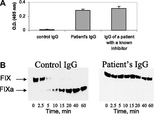 Figure 2. Characterization of the FXI inhibitor. (A) Binding of IgG (4 mg/mL) from a healthy control, the herein reported patient, and a patient with severe inherited FXI deficiency with a known inhibitor to plates coated with purified FXI. (B) Western blots at different time points from reaction mixtures of purified FIX with FXIa and calcium ions, incubated in the presence of control IgG and patient's IgG (4 mg/mL). Note the cleavage of FIX in the presence of control IgG and lack of cleavage in the presence of the patient's IgG.