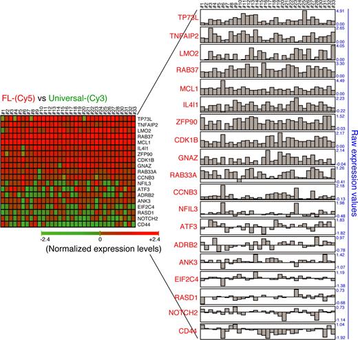 Figure 5. Gene cross-validation in human primary follicular B-cell lymphomas. Correlation in gene expression profile of MCL1-positive primary follicular B-cell lymphomas. Gene expression profiling was performed in 33 cases of follicular B-cell lymphomas using CNIO Oncochip 12K microarrays (ArrayExpress accession number A-MEXP-261). Total RNA was isolated in 2 steps using Trizol (Invitrogen) followed by RNeasy (Qiagen, Valencia, CA) purification. Amplification of RNA was performed from 4 μg of total RNA using the Superscript System for cDNA synthesis (Invitrogen) and the T7 Megascript in vitro transcription kit (Ambion, Austin, TX). Amplified RNA (2.5 μg) was directly labeled with Cy5-conjugated dUTP. RNA (2.5 μg) from the Universal Human Reference RNA (Stratagene) was labeled with Cy3-conjugated dUTP as reference. Raw data (Cy5/Cy3 ratios) for 33 cases of MCL1-positive human follicular B-cell lymphoma are shown.