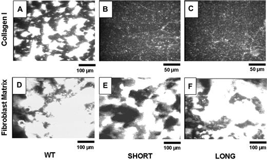 Figure 3. Ex vivo perfusion studies. Blood from 5 to 8 mice was pooled to perform each experiment. Representative images show platelet adhesion in WT mice (panels A and D), Gp6−/−SHORT mice (panels B and E), or Gp6−/− LONG mice (panels C and F) to insoluble, fibrillar Type I collagen (panels A-C) or mouse fibroblast matrix (panels D-F). These results are representative of more than 4 experiments using genetically similar mice. The bar in the bottom right corner of each panel indicates distance, such that the magnification in panels B and C is twice that of the remaining panels.