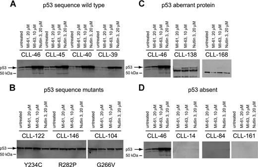 Figure 2. p53 expression levels at baseline and in response to MDM2 inhibition in CLL. Total protein from untreated, MI-61–treated, and MDM2 inhibitor (MI-63, Nutlin3)–treated cell samples was fractionated by SDS-PAGE, transferred to PVDF membrane, and prepared for immunoblotting with anti-p53 mAb. Membrane was developed using HRP-conjugated antimouse Ab followed by ECL-plus. (A) Four different CLL samples with wild-type p53 exon 5 to 9 sequence; treatments for individual samples/lanes are indicated. (B) Three different CLL samples with mutant p53 exon 5 to 9 sequence; treatments for individual samples/lanes are indicated. (C) Two CLL samples (nos. 138 and 168) with frameshift mutants of p53 compared with a wild-type CLL sample (no. 46); treatments for individual samples/lanes are indicated. (D) Three CLL samples with absent p53 expression (nos. 14, 84, and 161) compared with a wild-type CLL sample (no. 46). The position of wild-type p53 is indicated by an arrow.
