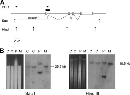 Figure 1. Identification of an 8.4-kb deletion upstream of MCFD2. (A) Schematic representation of the genomic region containing MCFD2 on human chromosome 2 (negative strand). Sac I and HindIII restriction sites are indicated by ↑, PCR oligonucleotide primers (not to scale) used to amplify and sequence the deleted allele are indicated by →←. The probe used for Southern blotting is shown as a black box. *The deletion eliminates 8.4 kb of DNA including exon 1 but retains 2 small sequences of 55 bp (in the 5′ genomic region, approximately 3.4 kb upstream of exon 1) and 96 bp (starting 9 bp inside intron 1) in inverted orientation. (B) Southern blot analysis with Sac I and HindIII. An image of the gel electrophoresis is shown to the left of each Southern blot, the patient's DNA sample (P) migrates more slowly than the samples from the controls (C) and from the patient's mother (M) so that the patient's normal band in both blots appears to be of greater size.