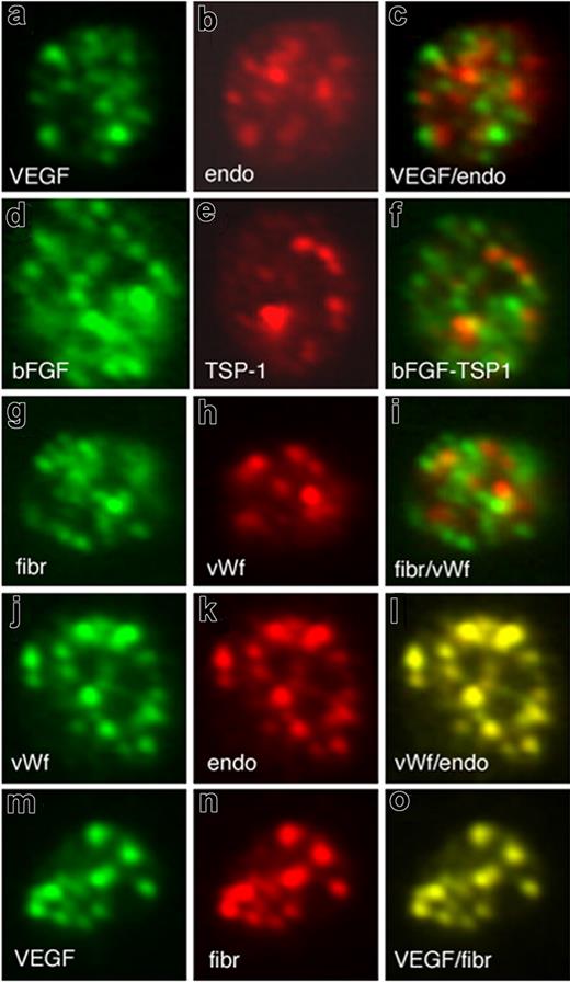 Figure 1. Pro- and antiangiogenic regulators organize into separate, distinct α-granules in resting platelets. Double immunofluorescence microscopy of resting platelets using antibodies against VEGF (A) and endostatin (B) and an overlay (C). Double immunofluorescence microscopy of resting platelets using antibodies against bFGF (D) and TSP-1 (E) and an overlay (F). Double immunofluorescence microscopy of resting platelets using antibodies against fibrinogen (G) and von Willebrand factor (H) and an overlay (I). Double immunofluorescence microscopy of resting platelets using antibodies against von Willebrand factor (J) and endostatin (K) and an overlay (L). Double immunofluorescence microscopy of resting platelets using antibodies against VEGF (M) and fibrinogen (N) and an overlay (O)..