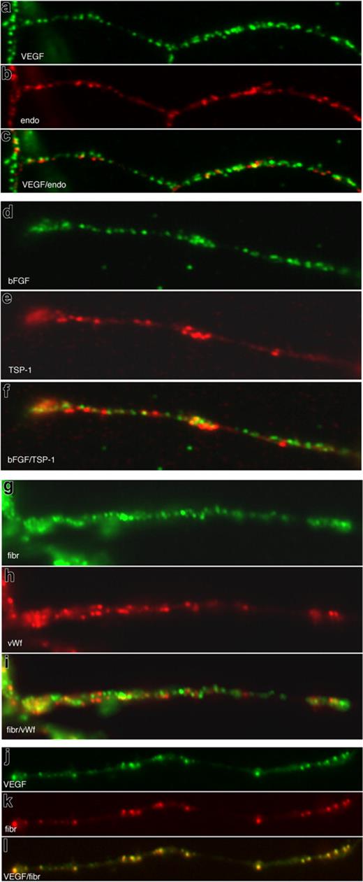 Figure 2. Pro- and antiangiogenic regulatory proteins are segregated into separate, distinct α-granules in megakaryocyte proplatelets. Double immunofluorescence microscopy of proplatelets using antibodies against VEGF (A) and endostatin (B) and an overlay (C). Double immunofluorescence microscopy of proplatelets using antibodies against bFGF (D) and TSP-1 (E) and an overlay (F). Double immunofluorescence microscopy of proplatelets using antibodies against fibrinogen (G) and von Willebrand factor (H) and an overlay (I). Double immunofluorescence microscopy of proplatelets against VEGF (J) and fibrinogen (K) and an overlay (L).