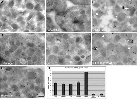 Figure 3. Localization of proteins in resting, human platelets using immunoelectron microscopy of ultrathin cryosections. Single immunogold labeling on ultrathin platelet sections was performed with anti-VEGF (A) and antiendostatin (B) antibodies. Double immunogold labeling on platelet sections was performed with the use of anti-VEGF antibody and antiendostatin antibodies. Large gold particles representing anti-VEGF staining (15 nm, arrows) are evident on one population of α-granules and small gold particles (5 nm) representing endostatin staining are abundantly present on a different population of α-granules (arrowheads) (C). Single immunogold labeling on ultrathin platelet sections was performed with antifibrinogen (D) and anti-VWF (E) antibodies. Double immunogold labeling on platelet sections was performed with the use of antifibrinogen antibody, which was revealed with a 15-nm, gold conjugate (arrows) and then with an antibody to VWF, which was revealed with a 5-nm, gold conjugate (arrowheads) (F). Single immunogold labeling on ultrathin platelet sections was performed with anti–P-selectin antibody (G). Gold particles representing P-selectin staining are abundantly present on the α-granules as well as the cell-surface membrane. Bar represents 300 nm. (H) The bar graph shows the quantitation of the percentage of α-granules positive (via immunogold staining) for specific factors. The data represent 3 separate experiments; error bars represent SD. More than 100 granules were scored for each study.