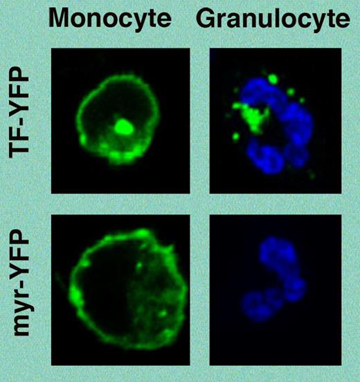 Figure 1. Granulocytes acquire TF from monocytes. Monocytes from blood were isolated and transfected with TF-YFP or myrisylated YFP (myr-YFP) and reintroduced to whole blood (adapted from Egorina et al in the article beginning on page 1208).