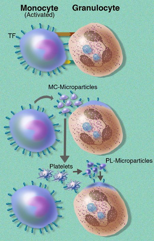 Figure 2. Potential pathways of TF transfer from monocytes to granulocytes. Granulocytes could acquire TF from monocytes by direct contact (top), fusion with monocyte-derived microparticles (middle), or fusion with platelet-derived mircoparticles containing monocyte-derived TF (bottom). MC indicates monocyte-derived; PL, platelet-derived.