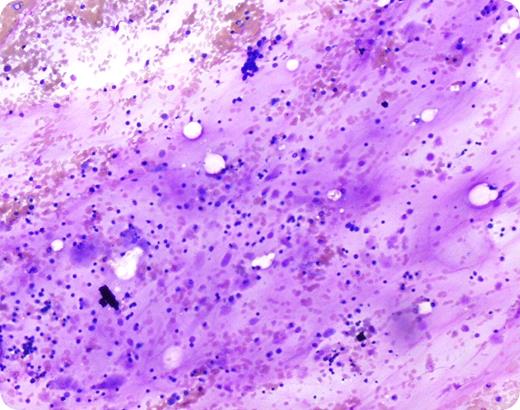 John Lazarchick, Children's Hospital of the Medical University of South Carolina