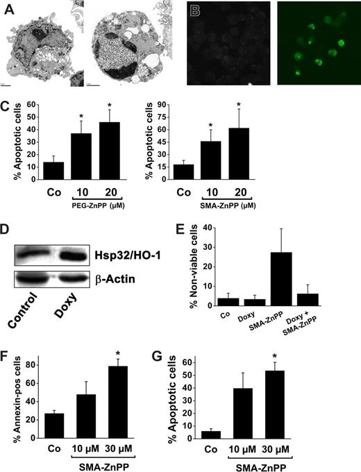 Figure 5. SMA-ZnPP induces apoptosis in CML cells. (A) K562 cells were incubated with control medium (left panel) or SMA-ZnPP (10 μM) (right panel) for 48 hours. Thereafter, cells were analyzed by electron microscopy as described in “Methods.” SMA-ZnPP was found to induce typical morphological signs of apoptosis (chromatin fragmentation/condensation). (B) K562 cells were incubated with control medium (left panel) or SMA-ZnPP (10 μM) (right panel) for 48 hours. Thereafter, cells were subjected to a Tunel assay. Apoptotic cells display bright green fluorescence. (C) K562 cells were incubated in control medium (Co) or in PEG-ZnPP or SMA-ZnPP (each 10 or 20 μM) at 37°C. After 48 hours, cells were subjected to annexin-V staining. Results show the percentage of annexin-V–positive cells and represent the mean ± SD of 3 independent experiments. *P < .05 compared with control. (D) K562-KRAB-HO-1 cells were cultured in control medium (Co) or in the presence of doxycycline (1 μg/ml) for 24 hours. Thereafter, expression of Hsp32/HO-1 was determined by Western blotting. β-actin is shown as loading control. (E) K562-KRAB-HO-1 cells were cultured in control medium (Co) or in the presence of doxycycline (1 μg/mL) for 24 hours. Thereafter, cells were kept in the absence or presence of SMA-ZnPP (10 μM) as indicated for 48 hours. Cell viability was determined by trypan blue exclusion test. Results show the percentage of trypan blue-positive cells and represent the mean (± SD) of 3 independent experiments. (F) Leukemic cells from untreated patients with CP CML were cultured in control medium or in the presence of SMA-ZnPP (10 μM or 30 μM) for 4 days. Thereafter, the percentage of apoptotic cells was determined by annexin-V staining and FACS analysis. Results represent the mean (± SD) of 3 patients. *P < .05. (G) Primary CML cells were cultured in the absence or presence of SMA-ZnPP (10 μM) for 5 days. Thereafter, the percentage of apoptotic cells was quantified on Wright-Giemsa-stained cytospin preparations. Results represent the mean (± SD) of 3 patients. *P < .05.