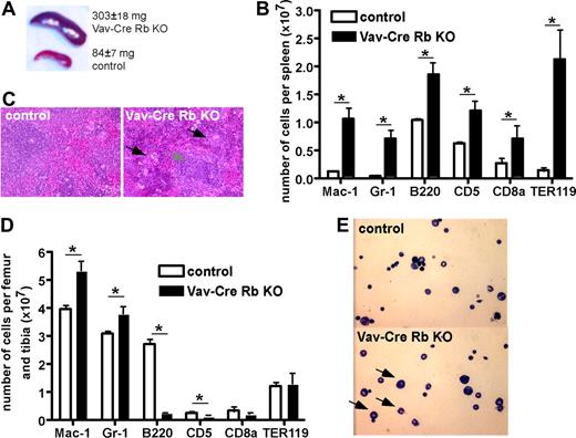 Figure 1. Altered contribution of distinct hematopoietic cell lineages in BM and spleen in Vav-Cre Rb KO animals. (A) Spleen size in control and Vav-Cre Rb KO animals (n = 7 for control, n = 10 for Vav-Cre Rb KO). (B) Hematoxylin-eosin stain of spleens from control and Vav-Cre Rb KO animals, indicating increased number of neutrophils and erythroblasts in spleen, although the overall architecture of the spleen is still preserved. (C) Flow cytometric analyses of spleens from control and Vav-Cre Rb KO animals for cell-surface markers associated with myeloid cells (Mac-1, Gr-1), B-cells (B220), T and B cells in the spleen (CD5), T cells (CD8a), and erythroid cells (Ter119; n = 5 for both control and Vav-Cre Rb KO). (D) Flow cytometric analyses of BM from control and Vav-Cre Rb KO animals for cell-surface markers associated with myeloid cells (Mac-1, Gr-1), B cells (B220), T cells (CD5, CD8a), and erythroid cells (Ter119; n = 5 for both control and Vav-Cre Rb KO). (E) Cytospins of BM from control and Vav-Cre Rb KO animals, indicating increased frequency of neutrophils in BM of Vav-Cre Rb KO animals. Shown are mean values plus or minus 1 SEM; *P < .05.