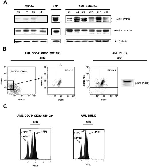Figure 2. Constitutive activating phosphorylation of SFKs in leukemic bulk and in immature CD34+CD38−CD123+ leukemic cells. (A) Normal CD34+ HPCs unstimulated or stimulated with GM-CSF, SCF and IL-3, KG1, and 53 AML samples (patient nos. 1, 2, 4–22, 24–28, 30, 31, 33–37, 40–44, 47–53, 56–63) were analyzed by Western blot using the phosphospecific antibody recognizing the activated form of SFK members (anti-pSrc Y416). The membranes were stripped and reprobed with the pan total Src antibody and a β-actin antibody as loading control. Data shown are representative of 3 independent experiments. Black stars indicate the position of Lyn. (B) Flow cytometric analysis of a sample from patient 66 using the 4-color protocol as described in “Flow cytometric analysis.” The left panel shows the CD34 versus CD38 dot plot (CD34+CD38− blast cell population is represented in gate A). Middle panel shows the CD123+ and p-Src Y416 expression in gate A. The right panel shows a sample of the leukemic bulk from patient 66 analyzed both by flow cytometry and by Western blot using the anti-pSrc Y416 antibody. (C) Patient cells were cultured for 1 hour alone or in the presence of PP2 (10 μM), then processed using 4-color immunostaining. The effect of PP2 on SFK phosphorylation was analyzed in the CD34+CD38−CD123+ blast subcompartment (patient nos. 64–68) and in the leukemic bulk (patient nos. 20, 42–44, 47–50, 52–53, 61–63). Results shown are representative of the different patients analyzed.