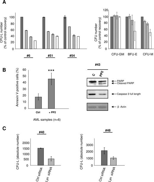 Figure 4. Activity of PP2 on normal HPCs and AML cell proliferation and survival. (A) Fresh AML cells (patient nos. 6, 51, 54) and normal HPC (right panel) were grown in clonogenic assays in the presence of increasing doses of PP2 (black bars, control; gray bars, 2 μM; hatched bars, 5 μM; white bars, 10 μM). Results are presented as percentage of control and are mean plus or minus SEM of duplicates. Results shown for normal CD34+ HPCs are mean plus or minus SEM of 2 independent experiments performed in duplicate. IC50 values were 4.8, 3.5, and 7.7 μM for patient nos. 6, 51, and 54, respectively. Five other patients (nos. 42, 47, 48, 50, 55) were also analyzed with IC50 values of 28.2, 9.5, 10.2, 14.5, and 0.5 μM, respectively. (B) AML samples (patient nos. 13, 42, 43, 44–46) were incubated with or without 10 μM PP2 for 24 hours, then processed for apoptosis studies using annexinV/PI staining and Western blot analysis using anti-PARP and anti-caspase 3 antibodies. Results are presented as mean percentages (± SEM) of annexin V-positive cells in treated vs untreated cells (***P < .001). (C) Fresh AML samples (patient nos. 40 and 48) were electroporated with Lyn siRNA or control siRNA, and their clonogenic properties were analyzed. CFU-Ls numbers were scored at day 7. Results are expressed as absolute number of leukemic colonies and are mean plus or minus SEM of duplicates.