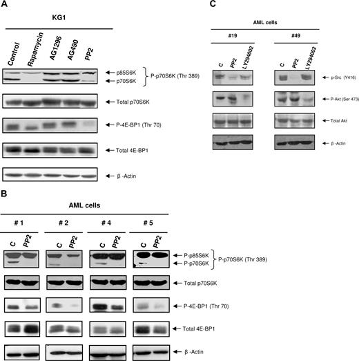 Figure 5. Inhibition of SFKs affects the phosphorylation of mTOR targets in AML cells. (A) KG1 cells were cultured for 1 hour alone (control) or in the presence of rapamycin (10 nM), AG1296 (25 μM), AG490 (20 μM), and PP2 (10 μM). Cells were lysed and analyzed by Western blot with the indicated antibodies. Results shown are representative of 3 independent experiments. (B) Fresh AML cells (patient nos. 1–20) were cultured for 1 hour alone or in the presence of PP2 (10 μM), lysed, and analyzed as in panel A. Results shown are representative of the different patients analyzed. (C) Fresh AML cells (patient nos. 7, 19, 21, 42, 43, 45, 49, 53, 59) were cultured alone or in the presence of PP2 (10 μM) or LY294002 (25 μM) for 4 hours, then processed for Western blot analysis.