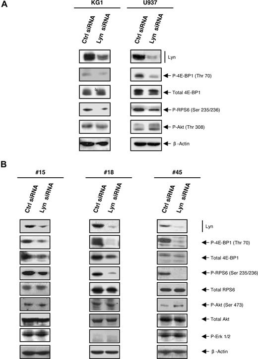 Figure 6. Silencing Lyn inhibits the mTOR pathway independently of Akt in AML cells. (A) KG1 and U937 were cultured after electroporation with Lyn siRNA or control siRNA. After 72 hours, cells were processed for Western blot analysis using appropriate antibodies. Results shown are representative of 4 independent experiments. (B) Fresh AML samples (patient nos. 15, 18, 45) were cultured during 48 hours after electroporation with Lyn siRNA or control siRNA, lysed, and analyzed by Western blot using indicated antibodies.