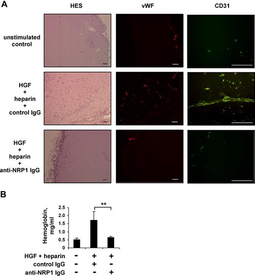Figure 6. Blocking anti-NRP1 antibody inhibits HGF-induced angiogenesis in a mouse Matrigel model. Mice were injected with Matrigel with or without an angiogenic cocktail and 20 μg/mL anti-NRP1 or nonimmune IgG. (A) Matrigel sections were analyzed by histology after HES staining and by immunochemical staining with an anti–von Willebrand factor or anti-CD31 antibody, using an Axioskop 2 plus fluorescence microscope (Carl Zeiss) equipped with Achroplan 4×/0.10 (left panel), Plan Neofluar 5×/0.15 (middle panel), or Plan Neofluar 40×/0.75 (right panel) objectives. Scale bar equals 100 μm. (B) Quantification of the hemoglobin content of plugs by spectrophotometry. **P < .01 (Student t test).