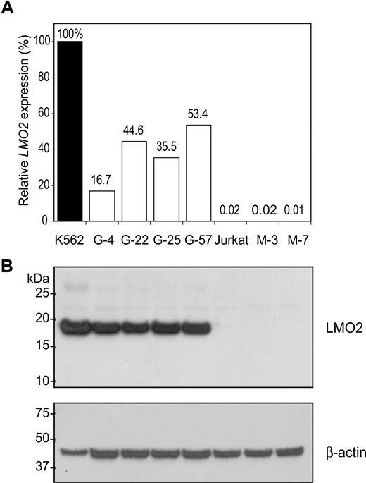 Figure 2. LTR mediated LMO2 activation. (A) The relative LMO2 expression was compared by real-time qRT-PCR. All targeted clones showed a significant increase in LMO2 transcript over control Jurkat cells. M-3 and M-7 are single cell clones of untransduced Jurkat cells. K562 erythroleukemia cells in which LMO2 is constitutively expressed were used as the positive control. Values are expressed as percentages relative to the K562 control. (B) Expression of LMO2 protein was confirmed by Western blot analysis. Consistent with the qRT-PCR results, LMO2 protein was abundant in targeted clones but not in untransduced Jurkat cells. The upper portion of the Western filter was probed with an antibody to β-actin to provide a lane-to-lane loading control.