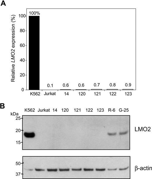 Figure 6. LMO2 is not activated by globin regulatory elements. A cassette containing the GFP coding sequences under the control of β-globin gene promoter along with the human β-globin LCR was used in the cassette exchange reaction in R-6 cells. Five clones were confirmed as having undergone the predicted exchange. Activation of the LMO2 gene in all 5 clones was minimal, if any, as determined by qRT-PCR (A) or Western blot analysis (B).