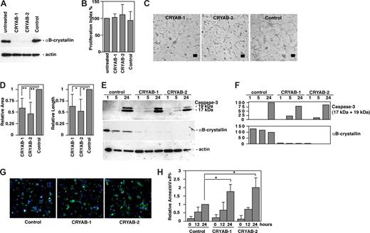 Figure 2. Knockdown of αB-crystallin in endothelial cells inhibits tubular morphogenesis. (A) TIME cells were transfected with siRNA oligos as described in experimental procedures. Whole cell lysates were prepared 3 hours after induction of tubular morphogenesis, and the knockdown of αB-crystallin expression by siRNA was analyzed by Western blot. Actin expression was used as a loading control. (B) SiRNA-transfected cells were counted 48 hours and 96 hours after transfection. Proliferation index was calculated as the increase in total cell number compared with untransfected control (n = 3; mean ± SD). (C) Tubular morphogenesis of endothelial cells transfected with αB-crystallin–specific siRNA (CRYAB-1 and CRYAB-2) or Alexa 488–conjugated control siRNA (bar = 100 μm). (D) Quantification of tube formation (area and length) compared with control siRNA-transfected cells analyzed by the Easy Image Analysis software (n = 3; mean ± SD; **P < .05; *P < .01). (E) Whole cell extracts from siRNA-transfected cells were prepared 1, 5, or 24 hours after induction of tubular morphogenesis, and the expression of αB-crystallin and cleaved caspase-3 (17-kDa and 19-kDa fragments) were analyzed by immunoblotting. (F) αB-crystallin and cleaved caspase-3 expression was quantified and normalized to actin expression using Image Gauge software. Values are given as percentage of expression compared with the 24-hour time point of control siRNA–transfected cells (set to 100%). (G) Annexin-V (green), PI (red), and Hoechst 33 342 (blue) staining of endothelial cells transfected with αB-crystallin–specific siRNA (CRYAB-1, CRYAB-2) and unconjugated control siRNA after 24 hours of tube formation in collagen gel. (H) Quantification of apoptosis in siRNA-transfected endothelial cells after 0 hours, 12 hours, and 24 hours of tube formation. Bars represent mean values and SD of the relative apoptosis rate (fraction of annexin-V–positive, PI-negative cells normalized to control siRNA at 24 hours) of 4 independent experiments (n = 4; mean ± SD; *P < 0,05).