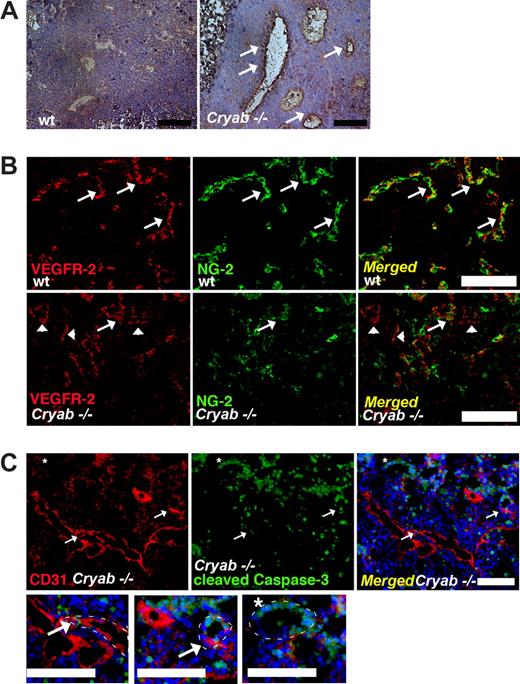 Figure 5. Tumor vessels in Cryab−/− mice are leaky, partially lack NG-2–positive pericyte coverage, and show signs of apoptosis. (A) Fibrin deposits (brown, indicated by arrows) around tumor vessels in wild-type (wt; left) and Cryab−/− (right) mice (bar = 100 μM). (B) NG-2–positive pericytes (green) in VEGFR-2 positive vessels (red) in tumors grown in wild-type (top) and Cryab−/− (bottom) mice (bar = 100 μm). Arrows show vessels covered by NG-2–positive pericytes, and arrowheads show vessels lacking pericyte coverage. (C) CD31-positive tumor vessels (red) in Cryab−/− mice with partial expression of proapoptotic cleaved caspase-3 (green, arrow) and (*) apoptotic vessel expressing cleaved caspase-3, magnified below (bar = 100 μM). White dotted lines in magnifications indicate the vessel borders.