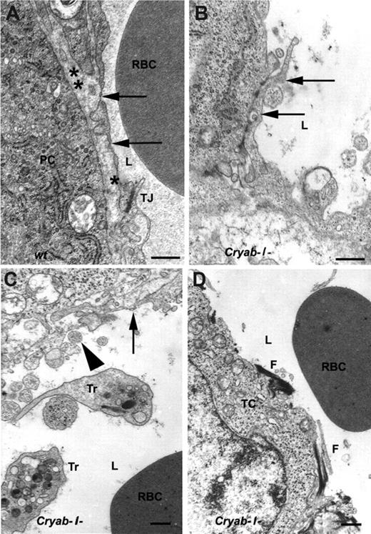 Figure 6. Transmission electron microscopy analysis reveals distorted and defective endothelium in tumor vessels in Cryab−/− mice. (A) A representative micrograph of a small tumor vessel in a wild-type (wt) mouse shows a fenestrated endothelial cell (arrow) resting on a basal lamina (*) and sealed to the neighboring endothelial cell with tight junctions (TJ). A pericyte (PC) with its own basal lamina (**) is located in close contact with the endothelium. A red blood cell (RBC) is seen in the lumen (L). (B-D) Representative micrographs of tumor vessels in Cryab−/− mice. (B) A blood vessel partially lined with fenestrated endothelium (arrow). (C) Defective endothelial lining (arrowheads) and remnants of an endothelial cell with fenestration (arrow). A red blood cell and 2 thrombocytes (Tr) are present in the lumen. (D) A vessel lacking endothelial lining with fibrous deposits (F) located directly on the surface of one of the surrounding tumor cells (TC). Original magnification for A,B, ×25 000; C,D, ×15 000. Bar equals 500 nm.