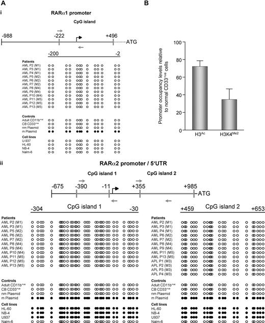 Figure 2. Mechanisms underlying loss of RARA expression differ between AML cell lines and patient samples. (A) RARα2 promoter is methylated in AML cell lines but not patient samples. Following bisulphite modification, specifically amplified PCR products were sequenced using primers (gray arrows) mapping to regulatory regions of (i) RARα1 or (ii) RARα2. CpG islands are indicated by heavy gray lines; all positions are shown relative to the transcription initiation sites (black broken arrows). Samples from patients, cell lines, and controls are indicated. nm indicates nonmethylated plasmid control; m, methylated plasmid control. Methylated CpG dinucleotides are represented by ●, and unmethylated CpGs are represented by ○. Sequencing revealed the RARα2 promoters of individual clones to be completely demethylated. All unmethylated samples were sequenced on both the sense and antisense strands, and no CpG hemimethylation was found. Methylation levels for RARα2 CpG island 1 from 3 bisulphite-modified APL patient samples were quantified by pyrosequencing,16 and a mean value of 3.7% methylated cytosine per CpG dinucleotide was observed. Bisulphite modification of genomic DNA was performed as previously described,17 and PCR primers were selected using the MethPrimer program18: BS-RARA1-Fwd, 5′-GTTTTGGGTTTGAGGGAGGGAT-3′ and BS-RARA1-Rev 5′-AACTTTACCCRAAACCCCAAACTAA-3′; BS-RARA2#1-Fwd, 5′-GGTYGGAGTTATATATGATGT-3′ and BS-RARA2#1-Rev 5′-AATAATCCCRATATCCTCCCCTTAA-3′; BS-RARA2#2-Fwd, 5′-GTAGAGTTGGGGTGGGGG-3′ and BS-RARA2#2-Rev, 5′-CAAAATACAACRACTCCCCAAATCC-3′. 1 and 2 refer to RARα2 CpG islands 1 (promoter) and 2 (corresponds to 5′ UTR of RARα2), respectively. PCR was performed using the FastStart system (Roche, Indianapolis, IN) supplemented with GC-rich solution. PCR products were separated by agarose gel electrophoresis, recovered, and sequenced directly using the previously mentioned PCR primers. For NB4 and U937 cell line samples, recovered PCR products were cloned into the pDrive vector (Qiagen) and sequenced using M13 forward and reverse primers. (B) Chromatin associated with the RARα2 promoter in primary AML cells is characterized by reduced transcriptional competence. Chromatin immunoprecipitation assays with antibodies directed against acetyl-histone H3 or dimethyl-histone H3 lysine 4 (K4) were performed on CD33+ CB cells and samples from AML patients (n = 2; consisting of AML FAB subtypes M4 and M5). DNA obtained from the input or from immunoprecipitated DNA was analyzed by real-time PCR using primers mapping to the RARα2 promoter region. Results were quantified as a percentage of immunoprecipitated material relative to input DNA, and levels of H3 acetylation (H3Ac) and H3K4 dimethylation (H3K4Me2) are shown relative to CD33+ CB cells. As expected, an irrelevant antibody-negative control did not immunoprecipitate the target DNA sequence (data not shown). The following PCR primers were used: ChIP-RARα2-Fwd, 5′-GAGCTGCACAATGTCACACC-3′ and ChIP-RARα2-Rev, 5′-GGCTGAACTCTCGCTGAACT-3′. Error bars are SD.