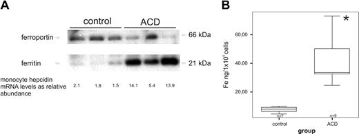 Figure 3. Association of monocyte hepcidin mRNA levels with monocyte ferroportin/ferritin expression and intracellular iron levels. (A) Freshly isolated blood monocytes were subjected to protein and RNA preparation for subsequent Western blotting and TaqMan PCR for determination of protein levels of ferroportin, ferritin, and β-actin as well as hepcidin mRNA levels. For Western blotting, one of 4 representative experiments is shown. (B) Freshly isolated blood monocytes were used for intracellular iron measurement by atom absorption technique as described in “Intracellular iron determination by graphite furnace atomic absorption spectrometry.” Data are depicted as lower quartile, median and upper quartile (boxes), and minimum/maximum ranges (whiskers; *P < .05, iron content in monocytes of control vs ACD patients by Student t test).