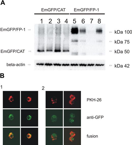 Figure 4. Monocyte-derived hepcidin causes ferroportin degradation in vitro. (A) Western blot of THP-1 cells transfected with EmGFP/CAT expression vector (lanes 1–4; as control) or EmGFP/ferroportin expression vector (lanes 5–8). Cells were either left untreated (control, lanes 1 and 5), cotransfected with a hepcidin expression vector for another 12 hours (lanes 2 and 6), treated with natural human hepcidin (1 μg/mL) for 3 hours (lanes 3 and 7), or stimulated with LPS 1 μg/mL for 6 hours (lanes 4 and 8). Monocytes were subjected to cell membrane extract preparation and subsequent Western blotting for quantification of EmGFP protein expression. Western blotting for β-actin was used as an internal control. One of 4 representative experiments is shown. (B) Immunofluorescence of THP-1 cells: Cells were transfected with ferroportin/EmGFP expression vector and left untreated (lane 1) or stimulated with LPS (1 μg/mL) for 6 hours (lane 2). PKH-26, a red fluorescence cell linker, was used for cell membrane staining. Ferroportin/EmGFP fusion protein showed green fluorescence. Colocalization of both results in a yellow staining. The size of the images is 360 × 360 μm displayed in original resolution of 1024 × 1024 pixel colored in 8 bit using the ×630 magnification.