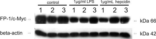 Figure 6. Effects of hepcidin challenge on the expression of ferroportin mutation variants. Western blots of THP-1 cells transfected with ferroportin/c-Myc expression vector (lanes 1, 4, and 7), A77D ferroportin mutant/c-Myc expression vector (lanes 2, 5, and 8), and N144H ferroportin mutant/c-Myc expression vector (lanes 3, 6, and 9). Cells were either left untreated (lanes 1–3), treated with LPS (1 μg/mL) for 6 hours (lanes 4–6) or exposed to native human hepcidin (1 μg/mL) for 3 hours (lanes 7–9). Monocytes were subjected to protein extract preparation and subsequent Western blotting for quantification of c-Myc protein expression. Western blotting for β-actin was used as an internal control. One of 3 representative experiments is shown.