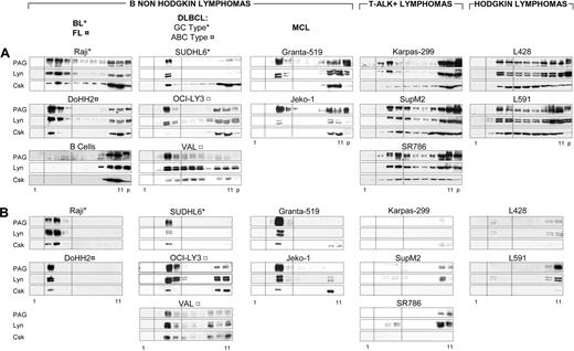 Figure 1. PAG and Lyn codistribute in detergent-resistant raft membranes of B-NHLs. (A) Subcellular fractionation of TX-100 lysates. TX-100 lysates (50 × 106 cells) of the indicated cell line loaded on sucrose gradient, ultracentrifuged to equilibrium, and 10 μL of each fraction was probed by WB with anti-PAG (MEM-255), anti-Lyn and anti-Csk. Fractions 1 to 11, from top to bottom. p: pellet of the equilibrium gradient containing nuclei and cytoskeleton. Dotted lines indicate the raft-containing fractions 3-5. (B) Sedimentability of the TX-100-resistant material. An aliquot (10 μL) of each gradient fraction was diluted 100-fold and ultracentrifuged (100 000g for 1 hour). The sedimented material probed by WB and raft fractions between dotted lines, as in panel A. Gradient fractionation was carried out at least twice for all cell lines and more than 5 times for Raji, DoHH2, SUDHL6, ALK+, and L428 lines.