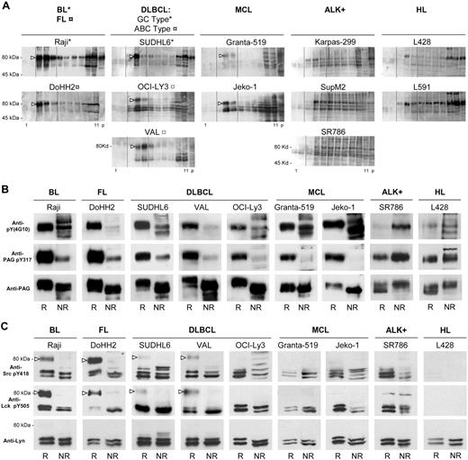 Figure 2. B-NHL rafts contain a predominant tyrosine phosphorylated component of 80 kDa. (A) Subcellular fractionation of TX-100 lysates as in Figure 1; 10 μL of each gradient fraction (as in Figure 1A) was probed with the antiphosphotyrosine 4G10 mAb. (B) Tyrosine phosphorylated PAG is part of the 80-kDa raft component. Raft and nonraft gradient fractions from the indicated cell lines containing each equivalent amounts of anti-PAG-reactive protein. R indicates fraction 3-5 (raft) proteins; NR, fraction 10-11 (nonraft) proteins. First row, WB with antiphosphotyrosine 4G10 antibody; second row, WB with antibody against peptide KEISAMpYSS, recognizing pY317 in PAG; third row, WB with anti-PAG antibody MEM-255. (C) Doubly tyrosine phosphorylated Lyn is part of the 80-kDa component in selected B-NHL rafts. Raft (R) and nonraft (NR) gradient fractions from the indicated cell lines containing each equivalent amounts of Lyn. First row, WB with anti-pY418 Src antibody; second row, WB with anti-pY505 Lck antibody; third row, WB with anti-Lyn antibody. Open arrowheads indicate the 80-kDa, antiphospho-Lyn-reactive component. Gradients and IPs were carried out 3 times for all cell lines, and representative experiments are shown.
