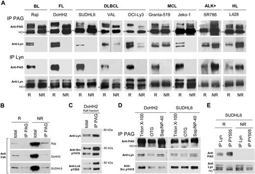 Figure 3. Lyn and PAG are associated in B-NHL rafts. (A) Raft (R) and nonraft (NR) aliquots (100 mL) from Raji, DoHH2, SUDHL6, Val, OCI-Ly3, Granta-519, Jeko-1, SR786, and L428 cells containing each equivalent amounts of either PAG or Lyn were IP with Sepharose-4B-coupled anti-PAG C-1 antibody (IP PAG, top 2 rows), or protein A/G-bound anti-Lyn antibody (IP Lyn, bottom 2 rows). IP materials were probed with anti-PAG MEM-255 mAb (first and third rows) or anti-Lyn antibody (second and fourth rows). Open rectangles indicate the H chain (HC) of the antibody used for IP. Vertical lines indicate repositioned gel lanes. (B) R and NR material (100 μL) from Raji, DoHH2, and SUDHL6, as in panel A) was IP with anti-PAG C-1 bound to Sepharose, and probed with anti-Csk antibody. Total: R and NR material (10 μL) probed directly with anti-Csk. (C) R material from DoHH2 (100 μL) was IP with Sepharose-bound anti-PAG C-1 (IP PAG) in 3 aliquots and probed by WB with: top, anti-Lyn; middle, anti-pY418 Src; and bottom, anti-pY505 Lck. Total: R material (10 μL) probed directly with the indicated antibodies. (D) PNS of 15 × 106 DoHH2 and SUDHL6 cells extracted with different detergents, subjected to IP with anti-PAG (PAG C-1) and WB with anti-PAG MEM 255, anti-Lyn, and anti-Src pY418. (E) R and NR material (100 μL) from SUDHL6 was IP with protein A/G-bound anti-Lyn, or anti-pY505 Lck antibodies, and probed with anti-PAG MEM-255 (first row) and anti-Lyn (second row). IPs described in this figure were carried out at least 3 times for each cell line.