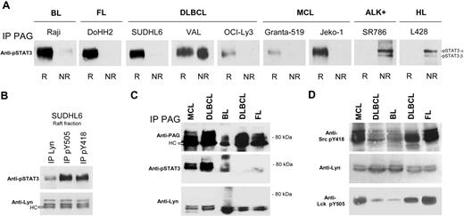 Figure 4. pSTAT3 selectively associates with the raft PAG/Lyn complex in B-NHL lines and lymphomas. (A) Raft (R) and nonraft (NR) material (100 μL) of the indicated cell lines was IP with anti-PAG C-1 antibody (same material as in Figure 3A) and probed with anti-pSTAT3 antibody. (B) Raft material from SUDHL6 was IP with protein A/G-bound anti-Lyn, anti-pY505 Lck, or anti-pY418 Src antibodies, and the IP material probed with anti-pSTAT3 (first row) and anti-Lyn (second row). (C) TX-100–resistant raft material isolated from frozen lymphoma tissues was treated with 50 mM OTG and IP with Sepharose-bound anti-PAG C-1 antibody. The IP material was probed with anti-PAG MEM-255 (top), anti-pSTAT3 (middle), and anti-Lyn (bottom). (D) Same material as in panel C: WB with anti-Src pY418, anti-Lyn, and anti-Lck pY505. pSTAT3 association with Lyn/PAG was ascertained at least 3 times for all cell lines, and IPs with patient material carried out twice with lymphomas of each type.