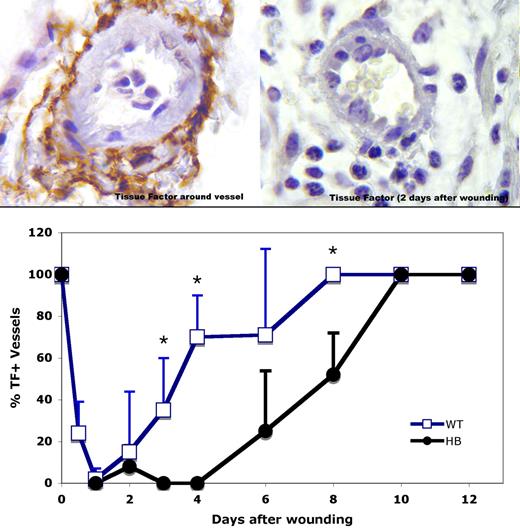 Figure 1. TF immunostaining around dermal vessels near sites of wounding. (Top panels) TF antigen is indicated by the brown color. Representative vessel profiles from WT animals are shown. Normal TF distribution around a dermal vessel is shown in the upper left, and 2 days after wound placement in the upper right. Original magnification 1000×. (Bottom panel) TF expression around vessels within 2 high-power (40×) fields of the wound bed was scored for 3 or 4 mice per time point, and means with SD are plotted. The SD values are 0 for days 0, 8, 10, and 12 for WT mice and 0, 10, and 12 for HB mice because all vessels were surrounded with a TF coat at these times. *P < .05 vs HB.