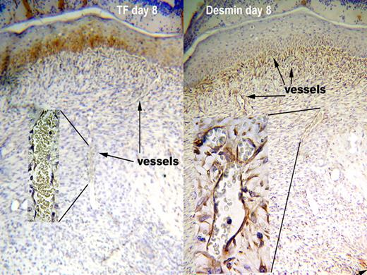 Figure 2. TF is absent from around vessels in granulation tissue even though pericytes are present. Antigen is indicated by the brown color. Representative sections from WT at day 8 after wounding are shown. TF was not present around vessels in the granulation tissue (left panel), since the intensity of staining was no greater than negative control sections stained with nonimmune rabbit IgG. The squamous epithelium above the granulation tissue does stain for TF. Vessels in the granulation tissue were surrounded by pericytes, as indicated by a layer of desmin staining around the vessels (right panel). The pattern of staining was consistent in 15 skin samples for TF and 23 for desmin, and was the same for WT and HB mice. Original magnification 100× and 1000× for insets.