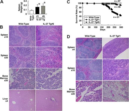 Figure 4. IL-27 Tg mice exhibit an increased number of megakaryocytes and splenomegaly with extramedullary hematopoiesis and shortened survival. (A) Spleen weight of wild-type (n = 31), IL-27 Tg no. 1 (n = 15) and no. 6 (n = 30) mice at 8 to 12 weeks of age was determined. Data are shown as the mean (± SD). * indicates P < .05, compared with wild-type mice. (B) Spleen, BM, and liver tissues of wild-type and IL-27 Tg no. 6 mice at 8 weeks of age were fixed in 10% buffered formalin, sectioned, stained with hematoxylin and eosin, and evaluated microscopically. (C) Survival rate of wild-type (n = 97), IL-27 Tg no. 1 (n = 51) and no. 6 (n = 46) mice was determined. (D) Spleen and BM tissues of wild-type and IL-27 Tg no. 1 mice at 40 weeks of age were fixed in 10% buffered formalin, sectioned, stained with hematoxylin and eosin, and evaluated microscopically. Images were acquired with an Olympus BX50 microscope system and 4×/0.13, 10×/0.30, and 20×/0.50 NA objectives (Olympus, Tokyo, Japan).