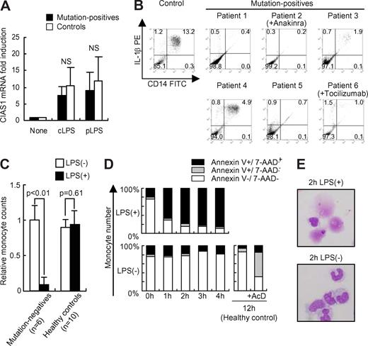 Figure 2. Monocytes from mutation-positive patients rapidly undergo cell death when treated with LPS. (A) Real-time quantitative reverse transcription (RT)-PCR analysis of CIAS1 mRNA. Purified monocytes were incubated with cLPS (10 ng/mL) or pLPS (10 ng/mL) for 1 hour, and were then subjected to quantitative real-time RT-PCR analysis. Data were normalized to 18S rRNA expression, and represent the means (± SD) of 4 mutation-positive patients or 7 healthy controls. NS: statistically not significant. (B) Intracellular IL-1β staining of PBMCs from CAPS patients. PBMCs from mutation-positive patients (n = 6) or healthy controls (n = 10) were incubated with cLPS (10 ng/mL) for 24 hours. Flow cytometric analysis was performed as described for Figure 1. Representative results of each patient, or the control healthy patients, are shown. Numbers in each quadrant are the percentages of total cells. (C) Monocyte cell number decreases upon LPS stimulation. PBMCs were incubated with or without cLPS (10 ng/mL) for 24 hours, as described in Figure 1. Data represent the number of CD14-positive cells in 10 000 PBMCs, compared with the preincubation state, and represent the means (± SD) of the indicated number of patients. (D) PBMCs from mutation-positive patients were stained with FITC-conjugated anti-CD14, PE-conjugated anti–annexin V, and 7-AAD. Samples were analyzed by flow cytometry, gated to select CD14-positive cells, and then analyzed for cell viability. Data from normal PBMCs that were treated with actinomycin D (AcD, 1 μg/mL) for 12 hours were used as a positive control for apoptotis. Representative data from 5 mutation-positive patients are shown. (E) Giemsa staining of monocytes from mutation-positive patients incubated for 2 hours with or without cLPS. Cells were observed by inverted microscopy using an Olympus BX51 microscope (Olympus, Tokyo, Japan) equipped with a 40×/0.85 NA objective lens, an Olympus DP70 camera, and DP-controller version 1.1 software (Olympus). Data are representative of 3 mutation-positive patients.