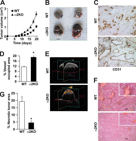 Figure 1. Enhanced growth of syngeneic, B16F10 melanoma in α2β1 integrin–deficient mice. (A) Tumor volume of B16F10 melanoma cells in α2-null mice (KO) and their wild-type (WT) littermates as a function of time. The data are presented as the mean plus or minus the standard error of the mean (SEM) with 18 animals of each genotype (P < .001, statistical analysis by ANOVA). (B) Photograph of tumors resected after 21 days (scale bar = 5 mm). (C) Representative photomicrograph of anti-CD31 antibody staining of tumor sections (scale bar = 50 μm; 20×/0.75 NA objective). (D) Total area occupied by CD31+ structures representing tumor vascular area as a percentage of total tumor area. Tumors from α2-null hosts show increased vascularity. Data are presented as the mean plus or minus SEM (9 tumors per genotype from 3 separate experiments; *P < .001). (E) The amplitude of blood flow within the tumor determined by power Doppler. There was a marked increase in blood flow to the tumor (as seen in yellow) in the α2-null mice in comparison to wild-type mice at 14 days after tumor injection. Total blood flow to the tumor was 7.68% (± 1.24%) in α2-null mice and 2.5% (± 0.43%) in the wild-type controls. A representative image from 3 separate experiments with 2 mice in each experiment is shown. (F) Representative low power images of hematoxylin and eosin–stained sections highlight tumor necrosis (necrosis outlined in black; scale bar = 100 μm; 10×/0.45 NA objective). (G) Tumor necrosis in wild-type and α2-null mice was morphologically quantitated. Necrotic area is presented as a percentage of the total tumor area from 5 low-power fields from 11 tumors per genotype. Data are presented as mean plus or minus SEM (*P = .002).