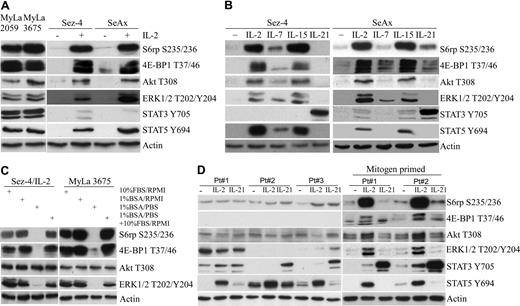 Figure 1. Activation of mTORC1 and other signaling pathways in CTCL cell lines and preactivated primary cells. (A) Western blots of protein lysates from 2 spontaneously growing and 2 IL-2–dependent CTCL cell lines were performed using a set of antibodies against the listed phospho-proteins from the mTORC1, PI3K/Akt, MEK/ERK, STAT3, and STAT5 signaling pathways. Antibody against actin served as a positive control. Before cell lysis, the IL-2–dependent cell lines were cultured without IL-2 for 24 hours and stimulated afterward for 30 minutes with 100 U of the cytokine or medium alone. (B) Western blots of protein lysates from the 2 IL-2–dependent/IL-2–depleted CTCL cell lines stimulated for 30 minutes with medium alone, 100 U of IL-2, 5 ng/mL of IL-7, 20 ng/mL of IL-15, or 100 ng/mL of IL-21 were performed using the same listed antibodies as in panel A. (C) The effect of serum and nutrient depletion on mTORC1 activation. The 2 CTCL cell lines were incubated for 20 hours in RPMI medium supplemented with 10% FBS or RPMI with 1% BSA (with a subset of samples cultured for the last 2 hours in PBS with 1% BSA), lysed, and analyzed for phosphorylation status of the mTORC1, PI3K, and MEK1/2 target proteins using the depicted antibodies. The 1% BSA/PBS cultures restimulated for 1 hour with the complete 10% FBS/RPMI medium served as positive controls. (D) Western blots of protein lysates from blood-circulating lymphoma cells isolated from 3 patients CTCL with an advanced leukemic (Sézary) phase and stimulated for 30 minutes with medium alone, 100 U of IL-, or 100 ng/mL of IL-21. Whereas some of the cell populations were examined directly after isolation (left), other were preactivated by a 7-day culture with a mitogen PHA (right).