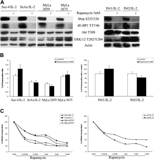 Figure 3. Rapamycin inhibits mTORC1-transduced cell signaling and proliferation of CTCL cells. (A) The CTCL cell lines (left) and mitogen preactivated primary leukemic CTCL cells (right) were cultured for 30 minutes with medium or 100 U of IL-2, as indicated, in the presence of rapamycin at 5nM or its solvent and analyzed for phosphorylation of mTORC1 targets S6rp and 4E-BP1 using phospho-Akt, phospho-ERK1/2, and actin as negative controls. (B) The CTCL cell lines and native, mitogen-primed cells were exposed to medium containing rapamycin at the indicated doses or solvent alone and examined for the apoptotic (B) and proliferative (C) cell rate after 24-hour and 48-hour cultures, respectively. Error bars are SEM.