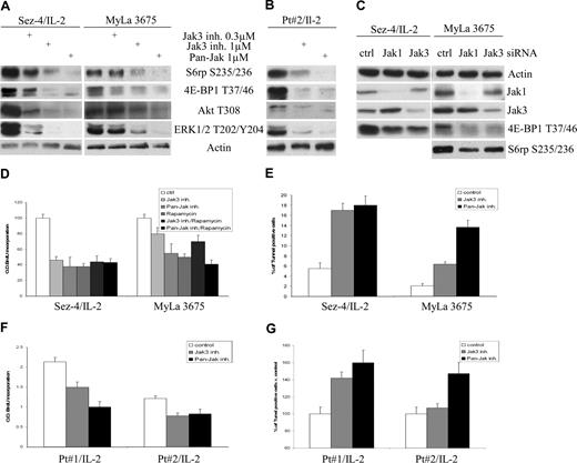 Figure 4. Jak1/Jak3 kinase-dependent activation of mTORC1 in CTCL cells. The CTCL cell lines (A) and mitogen preactivated primary leukemic CTCL cells (B) were cultured for 2 hours with medium or 100 U of IL-2, as indicated, in the presence of Jak3 or pan-Jak inhibitor used at the listed concentrations, lysed, and examined with the listed antibodies. (C) The CTCL cell lines were pretreated at 0 and 24 hours with 100 nM nonsense (control) or Jak1- or Jak3-specific siRNA, cultured for an additional 24 hours, lysed, and analyzed with the indicated antibodies. The CTCL cell lines (D) and mitogen preactivated primary leukemic CTCL cells (F) were cultured for 48 hours with medium or 100 U of IL-2, as indicated, in the presence of 1 μM Jak3 inhibitor, 1 μM pan-Jak inhibitor, or 5 nM rapamycin either alone or in combination with the Jak inhibitors as indicated, and analyzed for the proliferative cell rate. The Jak3 and pan-Jak inhibitor-treated CTCL cell lines and preactivated primary cells were also analyzed for the apoptotic cell death rate (E and G, respectively).