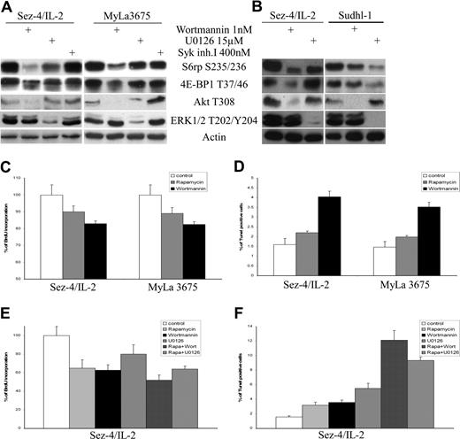Figure 5. mTORC1 activation is transduced in CTCL cells preferentially by PI3K/Akt compared with MEK/ERK signaling pathway. CTCL cell lines (A) and CTCL and ALK + TCL (Sudhl-1) cell lines (B) were exposed for 1 hour to solvent, PI3K inhibitor wortmannin, MEK1/2 inhibitor U0126, or Syk inhibitor I at the indicated doses and analyzed in Western blots with the listed antibodies. The CTCL cell lines were also exposed to 2 nM wortmannin for 8 hours (readministered every 2 hours), 5 nM rapamycin, and evaluated for the proliferative (C) and apoptotic (D) cell rate. The effect on cell proliferation (E) and apoptosis (F) of combining rapamycin (0.5 nM) with wortmannin (10 nM) or U0126 (0.5 μM in panel E and 15 μM in panel F) was also determined in the 48-hour and 24-hour assays, respectively.