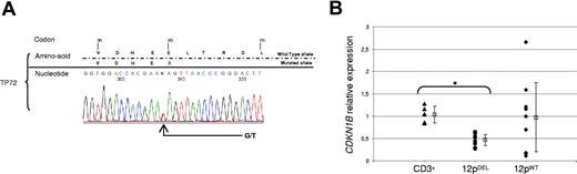 Figure 1. Genomic and expression analyses of CDKN1B in human T-PLL samples. (A) Sequence analysis of CDKN1B exon 1 amplified from the TP72 DNA leukemic sample. This patient carried a c.118G>T/p.E40X nonsense mutation in one allele. Chromatogram is shown on the bottom panel; sequence is indicated above. K=G+T. Putative translation of both alleles is shown on the upper panel using the single letter code. X indicates the stop codon. (B) Expression analysis of 20 T-PLL cases and of CD3+ T cells from 5 healthy individuals. Means are indicated as empty squares; plus or minus SDs are indicated as lines. An asterisk indicates the significance at P < 10−3 of the between-group analysis (bracket) determined by Student t test. CD3+ indicates control CD3+ T cells; 12pDEL, patients with 12p13 deletion; and 12pWT, patients without evidence of 12p13 genomic alteration. CDKN1B relative expression is expressed as 2− ΔΔCt in which ΔCt = CtCDKN1B − CtGUSB; ΔΔCt = ΔCtsample − ΔCtcalibrator.