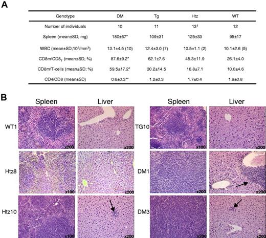 Figure 3. Analysis of the animals at 14 months of age. (A) Characteristics of the 4 genotypes at the age of killing. DM indicates Cdkn1b+/−/MTCP1TG; Tg, MTCP1 transgenics; Htz, Cdkn1+/−; WT, wild type; WBC, white blood cell count; CD8m/CD8T, ratio of CD8 memory cells (CD8+CD44HI) to total CD8+ splenocytes determined by FACS; CD8m/T-cells, ratio of CD8 memory cells (CD8+CD44HI) to total T-cell splenocytes (CD4+ and CD8+ lymphocytes) determined by FACS; CD4/CD8, ratio of CD8+ splenocytes to CD4+ splenocytes determined by FACS; §, 2 mice developed an erythroid metaplasia and were excluded from the study; *, significantly higher by Student t test in DM mice compared with the 3 other cohorts with P < .05; and **, significantly lower by Student t test in DM mice compared with the 3 other cohorts with P < .05; in parentheses is indicated the number of mice analyzed for WBC. (B) Histopathological analysis after HES staining of liver and spleen from characteristic mice for each genotype. Images were acquired with a DMRB microscope with 10×/0.30 and 20×/0.50 PL Fluotar objective lenses (Leica, Rueil-Malmaison, France) equipped with a KY-F50 Tri CCD camera (JVC, Clara Vision, Massy, France) and analyzed with Vega v2.0 software (Clara Vision) without further image processing. The lymphocytic nodules are indicated by arrows. Magnifications are indicated.