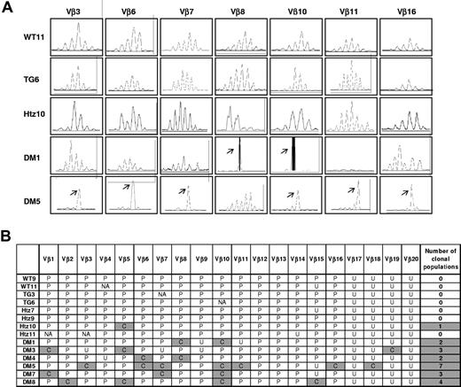 Figure 4. Multiple emergence of leukemic clones in Cdkn1b+/−/MTCP1TG mice. (A) The presence of clonal populations was detected by CDR3 spectratyping. Examples of chromatograms are shown for different mice from the 4 genotypes, and different Vβ segments used for Tcrb rearrangements. Black rectangles indicate signal saturation. Arrows indicate rearrangements fulfilling criteria for clonality. DM indicates Cdkn1b+/−/MTCP1TG; Tg, MTCP1 transgenics; Htz, Cdkn1+/−; and WT, wild type. (B) Summary of spectratyping data from the 14 mice tested. P indicates polyclonal pattern; C, clonal pattern; U, unknown, no significant signal; and NA, not available.