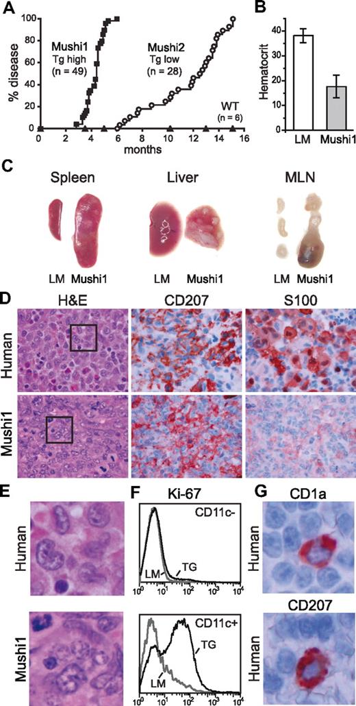 Figure 2. Mushi1 and 2 mice develop histiocytosis. (A) The high and low Tg-expressing Mushi1 and Mushi2 lines show an early and late development of disease signs (anemia and general symptoms), respectively. (B) Hematocrit values in percentage of healthy control (LM) and diseased Mushi1 mice (Tg). (C) Multiple nodules and organ enlargement in spleen, liver, and mesenteric LN (MLN) from diseased mice (Mushi1) compared with healthy controls (LM). (D) Similar histologic characteristics in human LCH in LN (human) and Mushi1 liver lesions (TG) are detected by hematoxylin & eosin (H&E) and immunostaining for Langerin (CD207) and S100. (E) Human and Mushi lesions show reniform nuclei (enlargement of D left column). (F) Expression of the cell cycle marker Ki-67 was tested by FACS in gated CD11c− and CD11c+ MLN cells from control (LM) and diseased (TG) mice. (G) Normal human spleen stained with anti-CD1a or anti-Langerin antibodies.