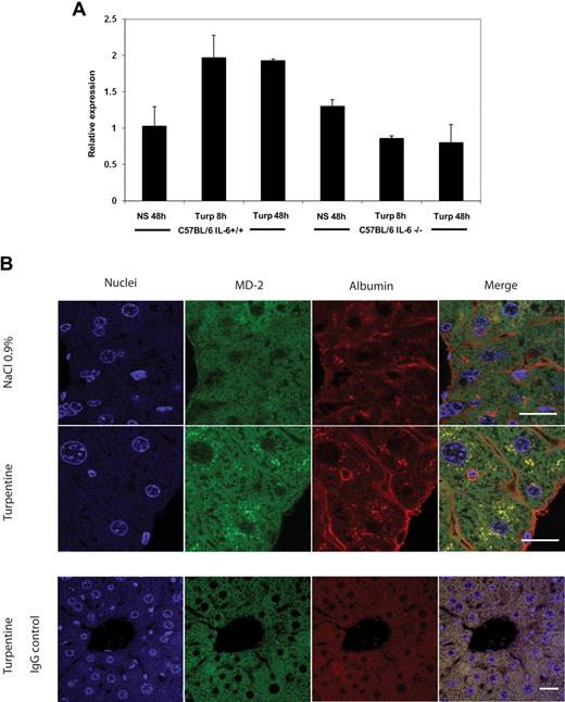 Figure 1. MD-2 is up-regulated in the liver from turpentine-treated mice and is dependent on IL-6. (A) MD-2 mRNA levels were measured in liver from C57BL/6 IL-6+/+ and C57BL/6 IL-6−/− mice 8 and 48 hours after paw injection of turpentine (turp) or normal saline (NS). Messenger RNA levels were measured by quantitative RT-PCR. Mean plus or minus SD MD-2 mRNA levels were normalized with the expression β-actin mRNA and expressed as arbitrary units. One experiment, 3 animals per group. (B) The MD-2 protein (green) is increased in liver from C57BL/6 wild type mice treated 8 hours with turpentine compared with mice treated with normal saline (NaCl 0.9%). MD-2 is up-regulated by hepatocytes because it colocalizes (merge, yellow) with albumin (red). The increased fluorescence is located in the perinuclear region of hepatocytes. No specific staining was observed with isotype controls in liver from turpentine-treated animals (bottom row). Bar equals 20 μm. Results were similar in 6 animals (3 per group).