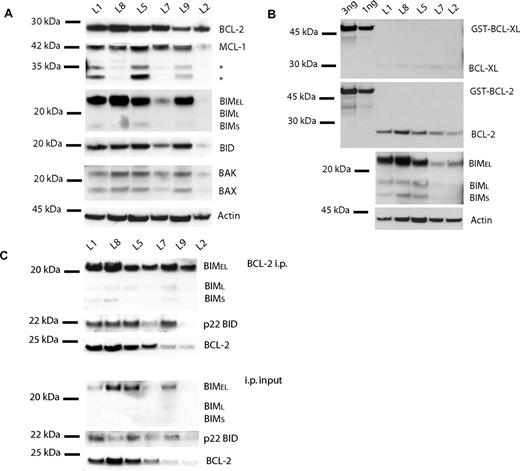 Figure 6. Protein analysis of primary ALL cells is consistent with whole-cell ABT-737 response and BH3 profiles. (A) Western blot analysis of CHAPS lysates (20 μg) shows detectable expression of BCL-2, MCL-1, BIM, and BID among primary ALL cells. (B) Purified GST-BCL-XL and GST-BCL-2 (1 and 3 ng) were run next to 5 independent ALL lysates (10 μg) to quantitate BCL-XL (top panel) and BCL-2 (middle panel). Primary ALL lysates with better equal loading reveal clearer BIM levels among samples (bottom panel). (C) BCL-2, BIM, and BID are also complexed in primary ALL cells. Anti–BCL-2 immunoprecipitation of ALL primary cells (50 μg). Immunoprecipitation pellet (i.p.) and 10% of total lysate used for immunoprecipitation (input) were loaded. BIM and BID are complexed to BCL-2 in amounts proportional to whole-cell amounts.