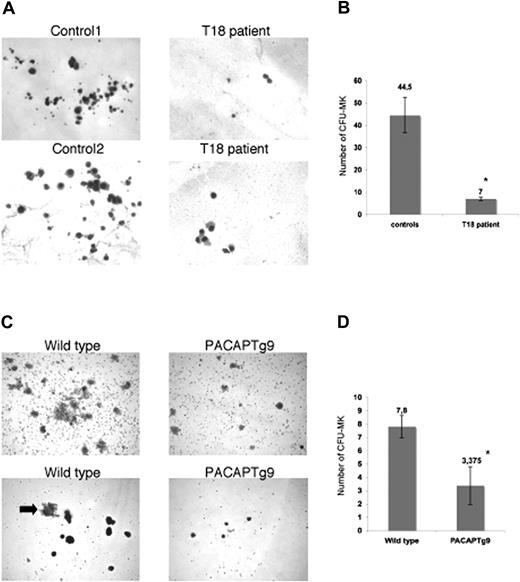 Figure 1. Megakaryocyte generation. (A) Megakaryocyte (MK) colonies on day 12 from bone marrow–derived CD34+ cells from a control donor or a patient with trisomy 18p with 3 copies of the PACAP gene. (B) Number of CFU-MKs from 5 × 103 bone marrow–derived CD34+ cells from 4 unrelated control donors or a patient with trisomy 18p. Bars represent the means plus or minus SD of the CFU-MK counts of 1 plate from the patient and 4 plates from 4 controls (*P < .001). (C) MK colonies on day 12 in wild-type and PACAPTg9 mice. Sca1+ bone marrow cells from wild-type mice develop into more and larger colonies compared with those of PACAPTg9 mice. MK are also larger (arrow) in wild-type mice. (D) Number of CFU-MKs from 5 × 104 bone marrow–derived Sca1+ cells from 8 PACAPTg9 mice or 5 wild-type littermate controls. Bars represent the means plus or minus SD of the CFU-MK counts of 1 plate for each PACAPTg9 and wild-type mouse (*P < .001).