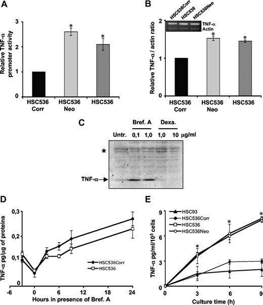 Figure 2. Analysis of TNF-α mRNA expression and level and protein expression and secretion. (A) TNF-α promoter activity in FA and corrected lymphoblasts. Cells were cotransfected with the reporter pGL3-hTNF-α-LucF and phRL-TK, used as internal control. Luciferase activity in HSC536Corr cells was considered equal to 1 in each experiment. Data presented are the mean (± SD) of at least 3 independent experiments done in triplicate. *P < .01. (B) Steady-state level of TNF-α mRNA in FA and corrected lymphoblasts assessed by semiquantitative RT-PCR. The histogram represents the relative level of TNF-α mRNA in FA-C–deficient compared with FANCC-corrected cells. The level in HSC536Corr was considered equal to 1 in each experiment. Data presented are the mean (± SD) of at least 3 independent experiments done in triplicate. *P < .05. (C) Immunoblot showing the level of TNF-α in total cell extracts prepared from HSC536 cell line either untreated (Unt) or treated for 18 hours with brefeldin A (Bref A) or dexamethasone (Dexa). A cross-reactive band (marked with asterisk) was used as a loading control. (D) Intracellular TNF-α accumulation in FA and corrected lymphoblasts. Cells were treated with dexamethasone (10 μg/mL) for 3 hours. After this incubation, cells were collected by centrifugation, washed, and resuspended in fresh medium in presence of brefeldin A (1 μg/mL) for 24 hours. Proteins were extracted at the indicated time points. TNF-α content was measured by ELISA. Each point represents the mean (± SD) of at least 3 independent experiments. (E) Kinetics of TNF-α accumulation in HSC93, HSC536Corr, HSC536, and HSC536Neo cell lines. Supernatants were collected 3, 6, and 9 hours after cell subculturing in fresh medium and cytokine release was determined by ELISA. Each point represents the mean (± SD) of at least 3 independent experiments. *P < .01.